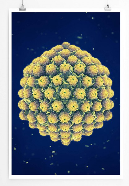 60x90cm Poster Wissenschaftliche Abbildung  Großabbild eines Herpesvirus